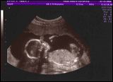 babytracy
